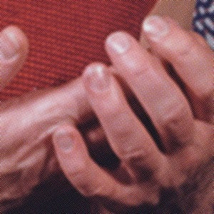 ALEKSANDIR - SKIN REMIXES