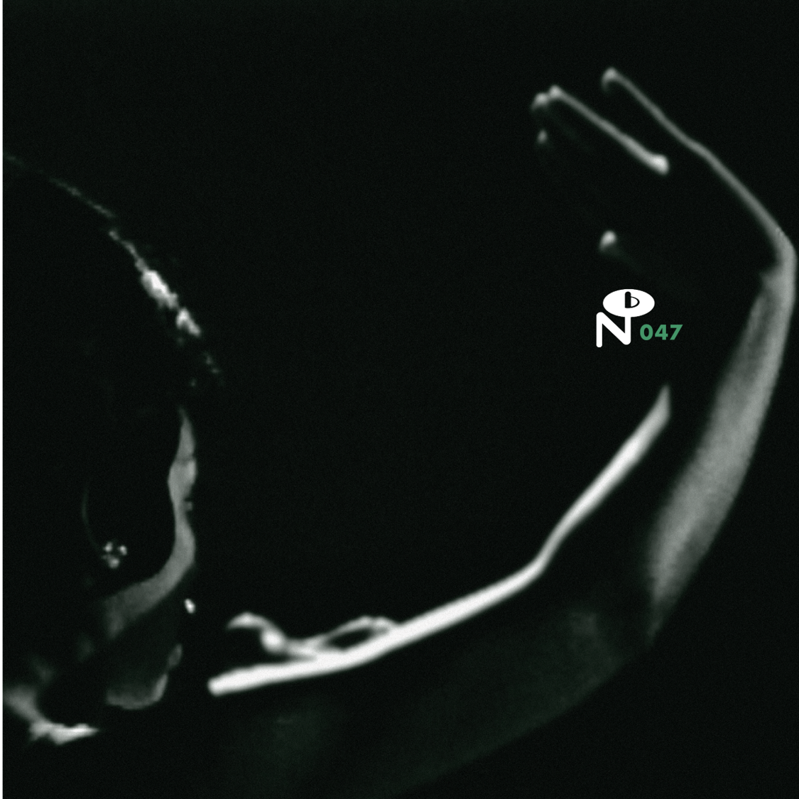 Various Artists - Eccentric Soul: The Forte Label [2LP Black vinyl]