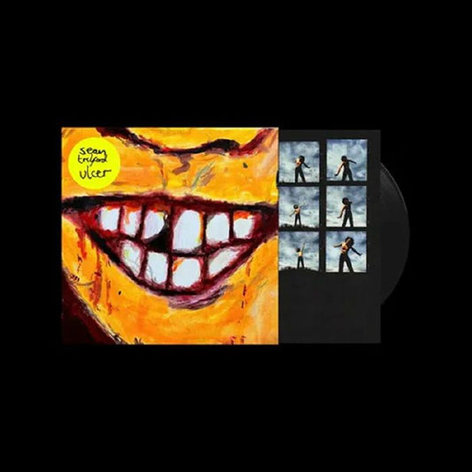 Sean Trelford - ulcer