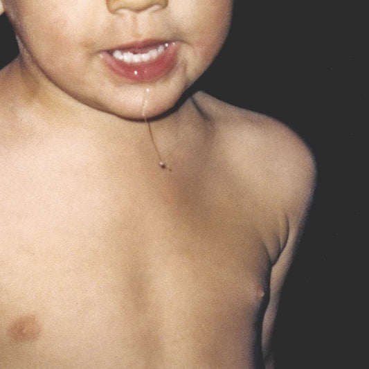 La Paloma - Todavia No [White LP]