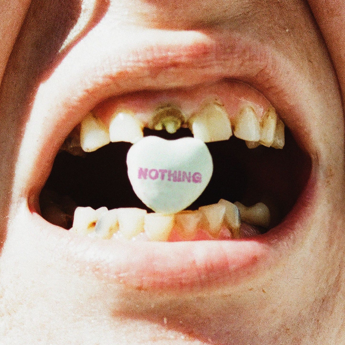 Nothing - a short history of decay [RFC First Run Club Version – Candy Corn Vinyl]