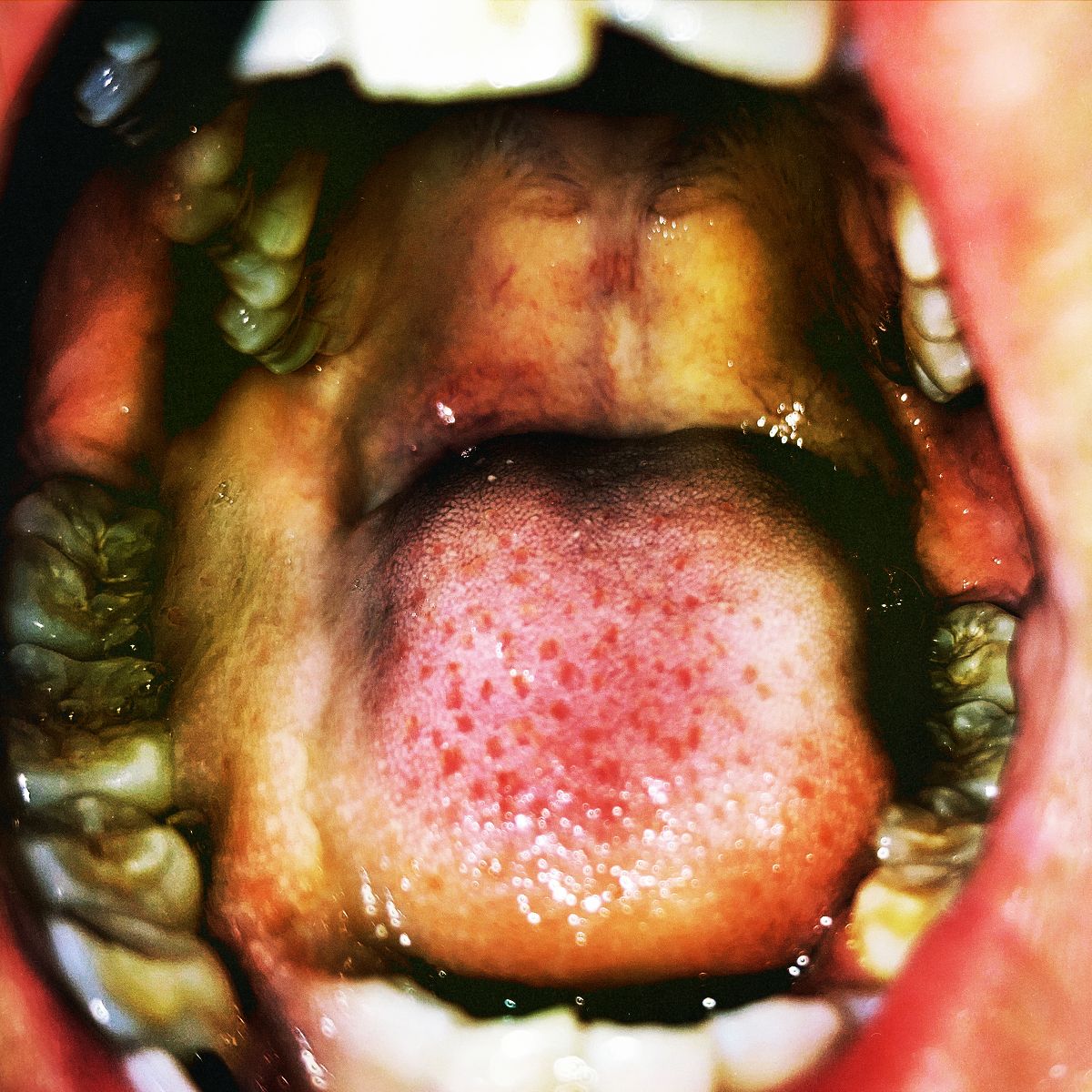 Hana Vu - Public Storage [LP]