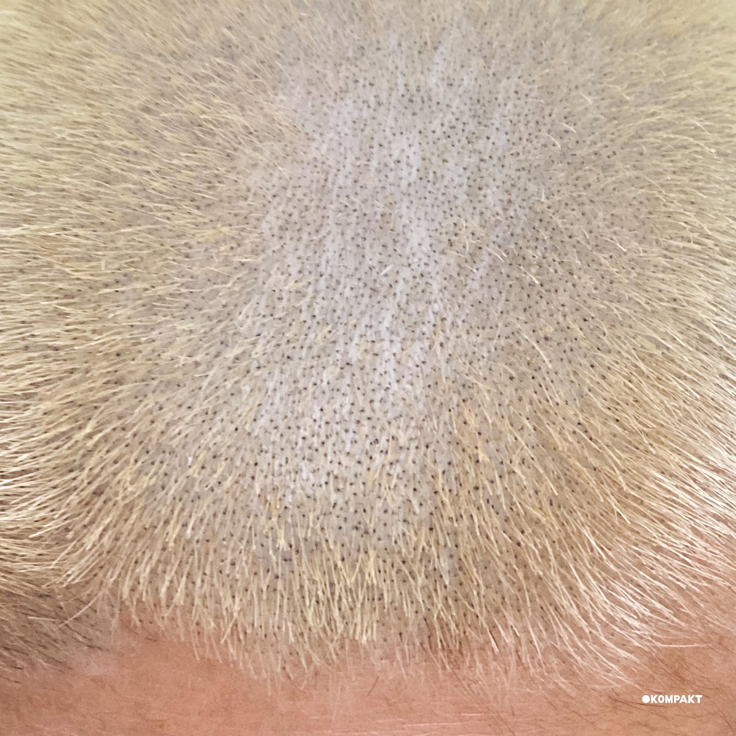 Barnt - ProMetal Fan Decor Only