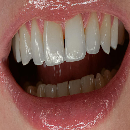 Valerie Ace - Glitzer Vs Hass [full colour sleeve / 180 grams]