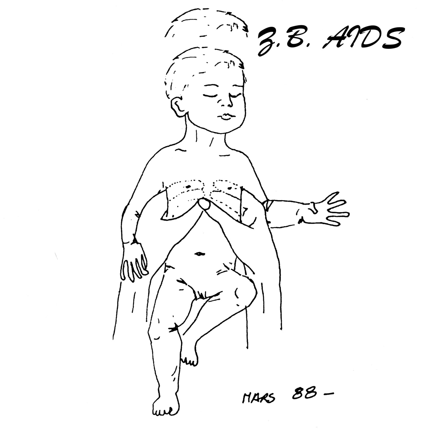 Z.B. Aids – Gestalt