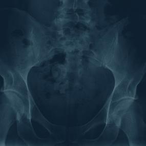 VARIOUS ARTISTS - ANTIPODEAN ANOMALIES 2